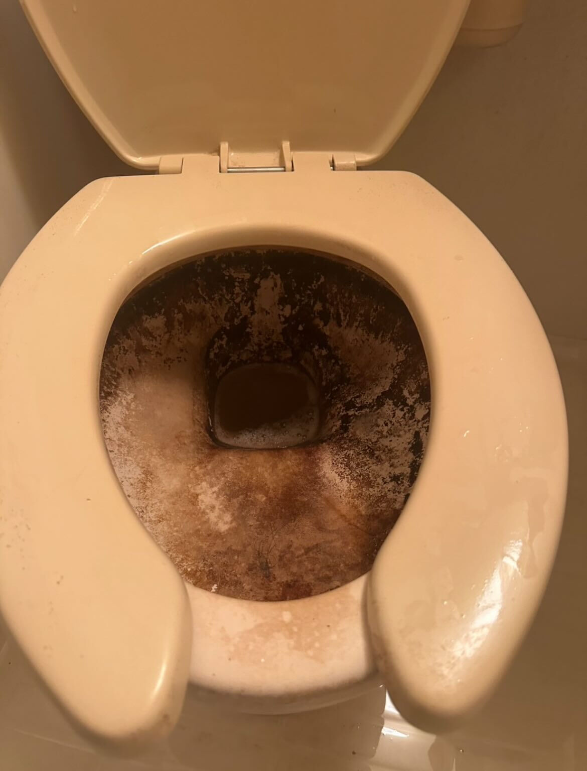 便器清掃